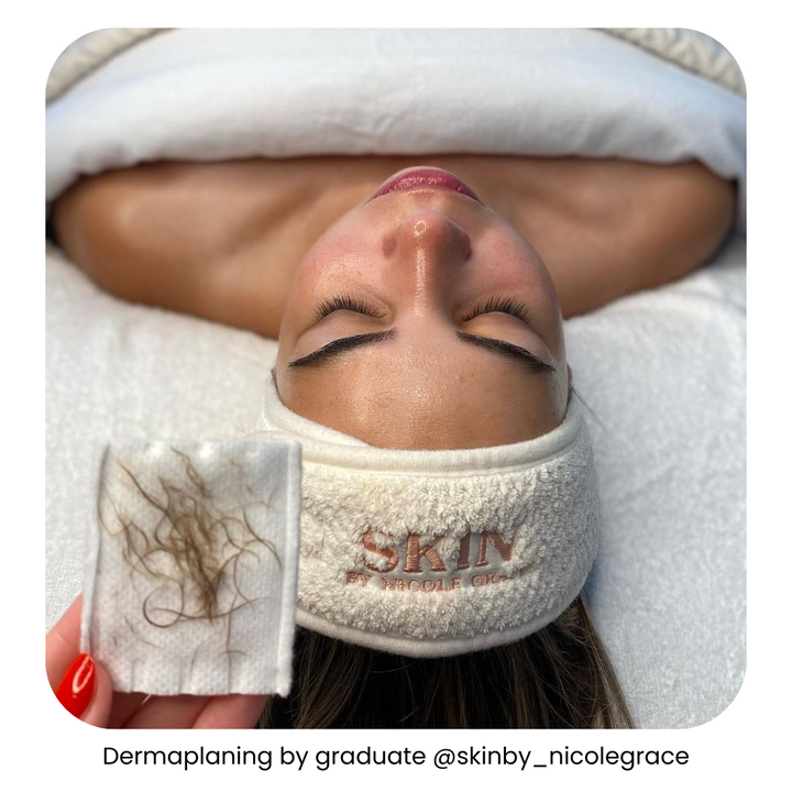 Woman’s face after dermaplaning facial by a graduate of IBI’s dermaplaning course